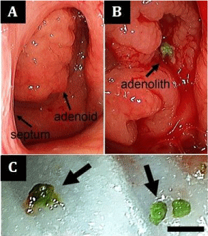Preoperative