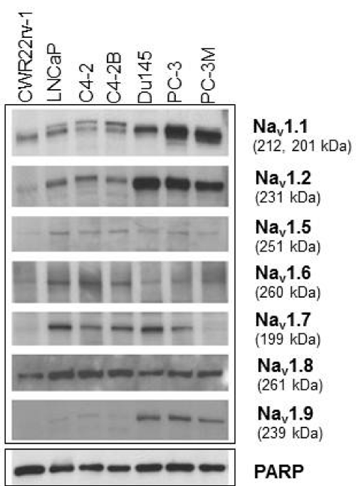 Prostate Cancer Cell Lines