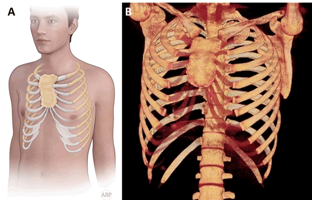 Journal-Pulmonary-Medicine-Anatomical-21-5-4-g003