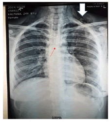 Journal-Pulmonary-Medicine-Chest