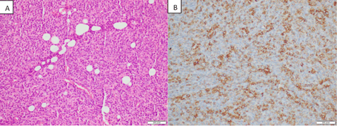 Journal-Pulmonary-Medicine-Histology