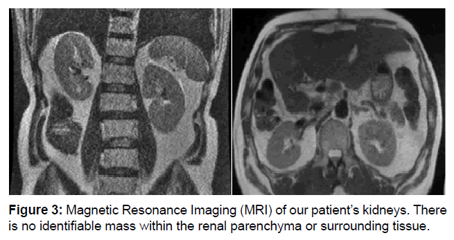 clinical-oncology-patients-kidneys clinical-oncology-patients-kidneys