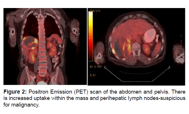 clinical-oncology-positron-emissio