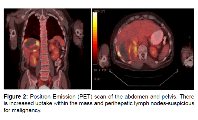 clinical-oncology-positron-emissio clinical-oncology-positron-emissio
