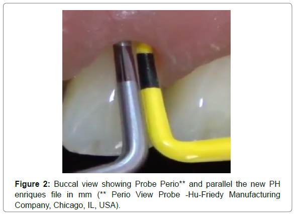 dental-health-current-research-Buccal