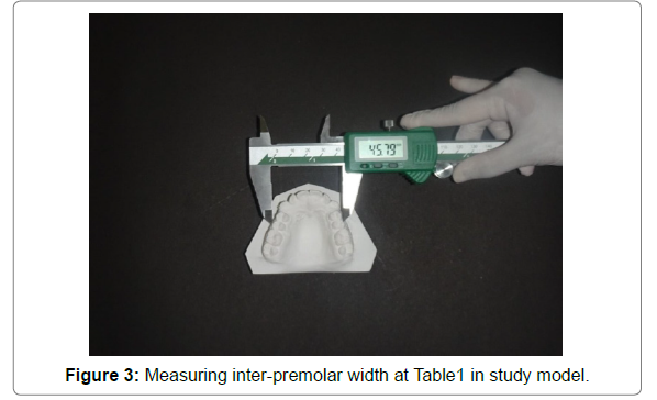 dental-health-current-research-Measuring