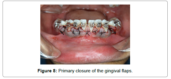 dental-health-current-research-Primary