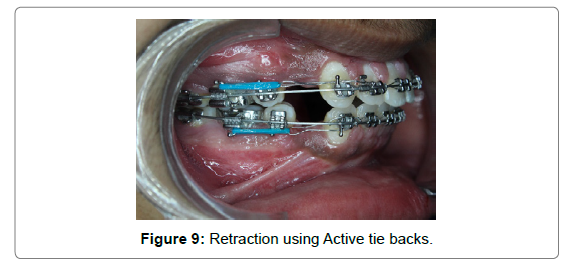 dental-health-current-research-Retraction