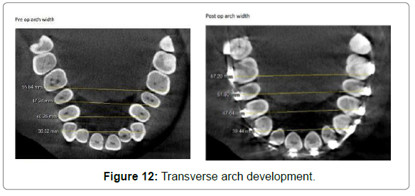 dental-health-current-research-Transverse