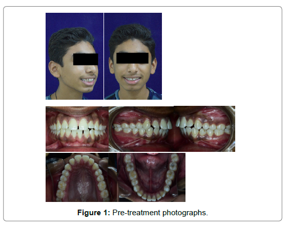 dental-health-current-researchphotographs
