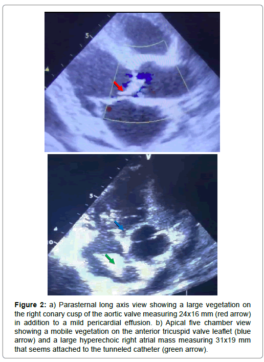 international-journal-of-cardiovascular-research-axis-view