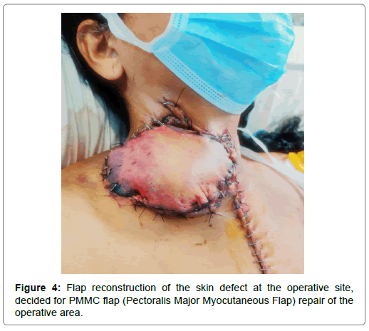 international-journal-of-cardiovascular-research-skin-defect