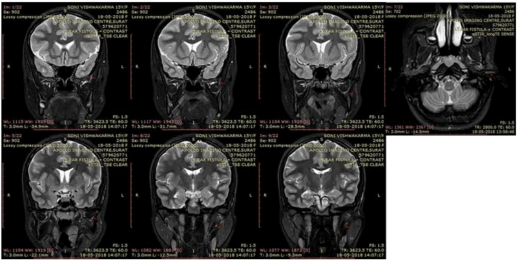 otology-rhinology-showing