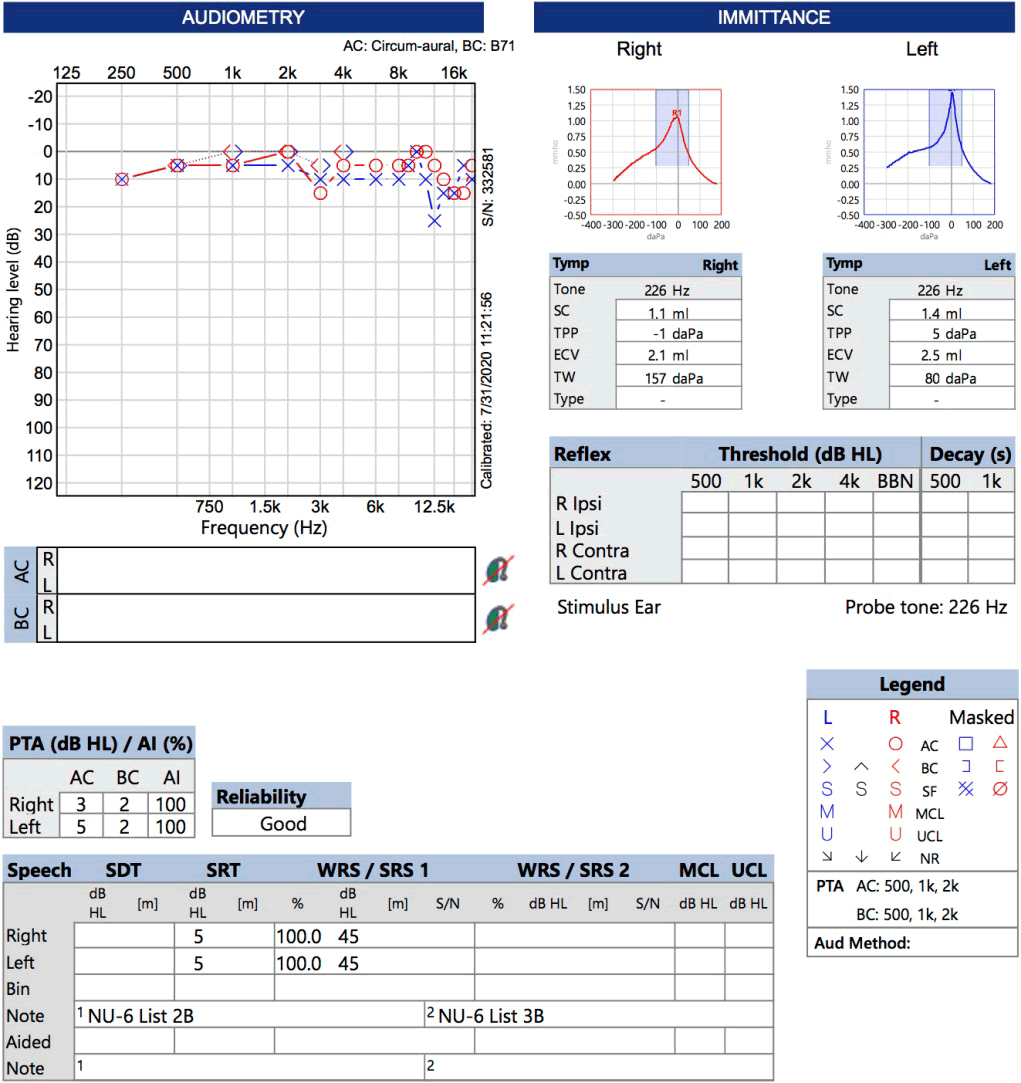 otology-rhinology-tympanometry-10-4-407-img001