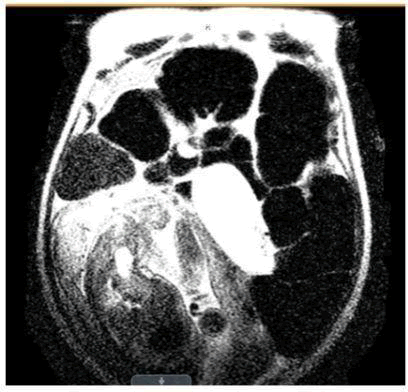 research-reports-coronal