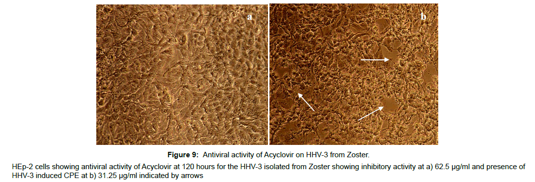 virology-antiviral-antiviral-activity