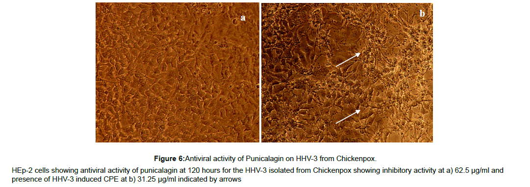 virology-antiviral-from-chickenpox