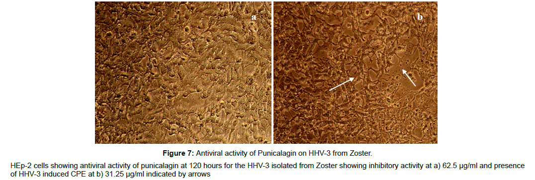 virology-antiviral-isolated-zoster