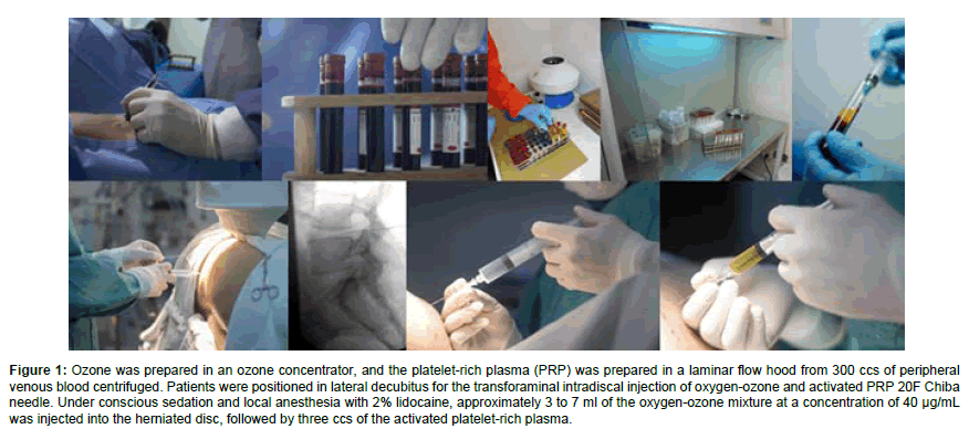 Regenerative-Medicine-platelet