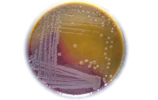 archives-medical-shigella