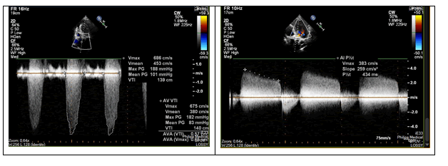 cardiovascular-research