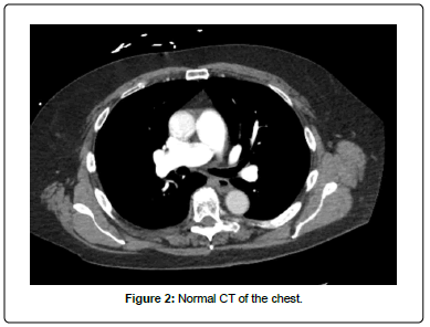 clinical-oncology-CT