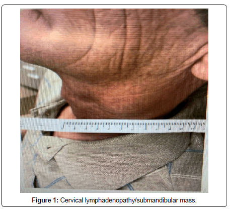 clinical-oncology-Cervical clinical-oncology-Cervical