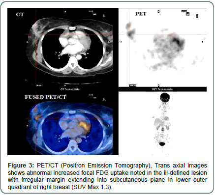 clinical-oncology-Emission