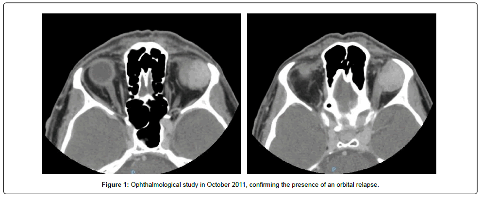 clinical-oncology-Ophthalmological clinical-oncology-Ophthalmological