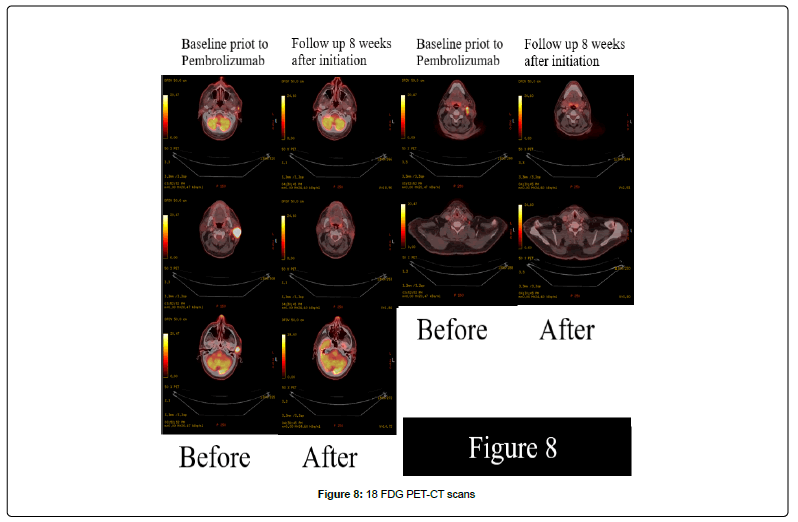 clinical-oncology-PET-CT