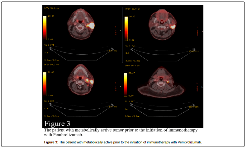 clinical-oncology-Pembrolizumab clinical-oncology-Pembrolizumab