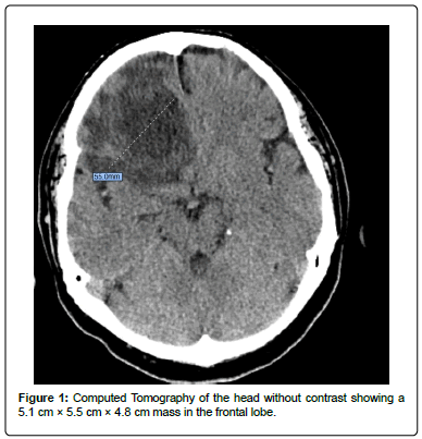 clinical-oncology-Tomography