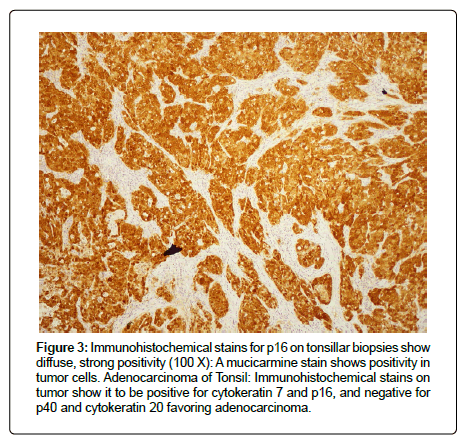 clinical-oncology-biopsies clinical-oncology-biopsies