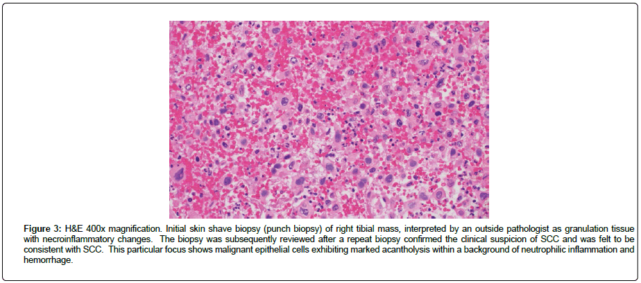 clinical-oncology-biopsy