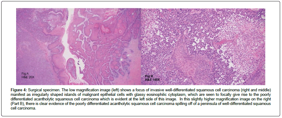 clinical-oncology-carcinoma