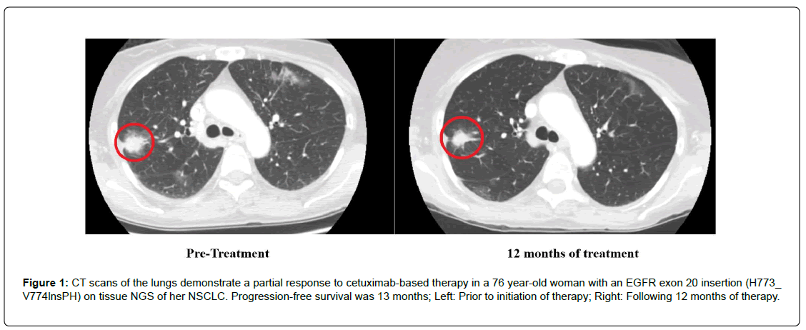 clinical-oncology-cetuximab