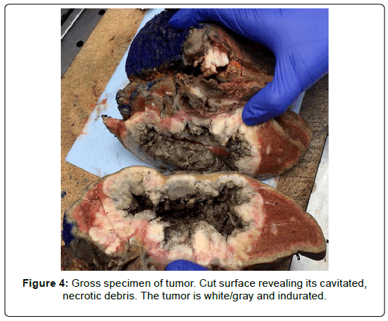 clinical-oncology-debris