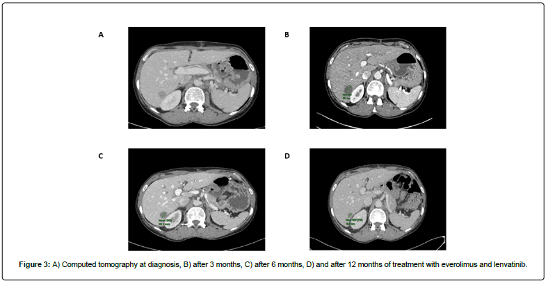 clinical-oncology-everolimus