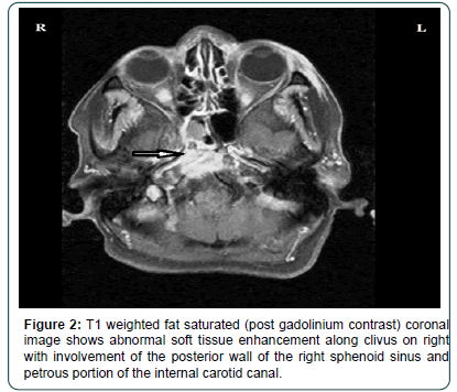 clinical-oncology-gadolinium