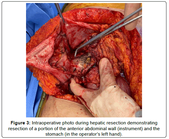 clinical-oncology-hepatic