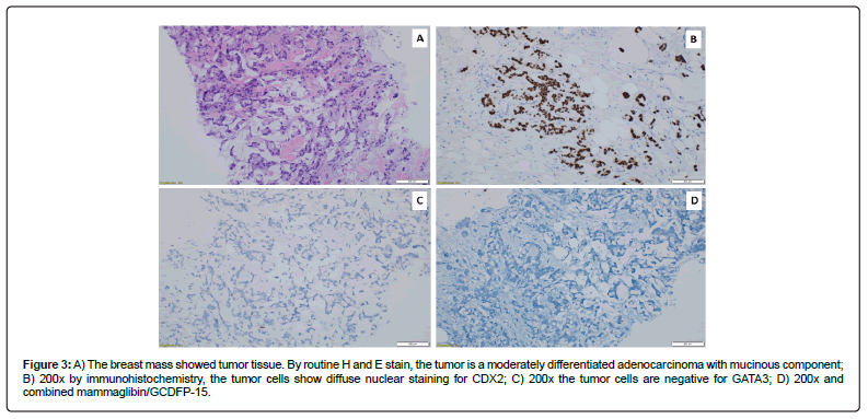 clinical-oncology-immunohistochemistry