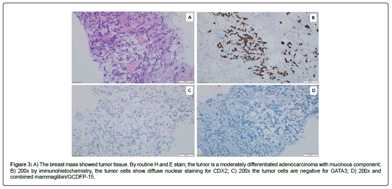 clinical-oncology-immunohistochemistry clinical-oncology-immunohistochemistry