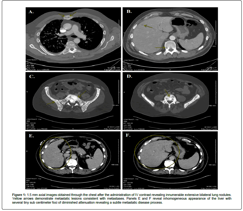 clinical-oncology-lung