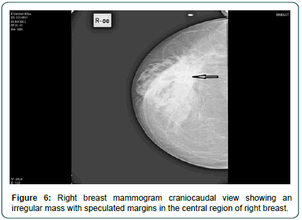 clinical-oncology-mammogram