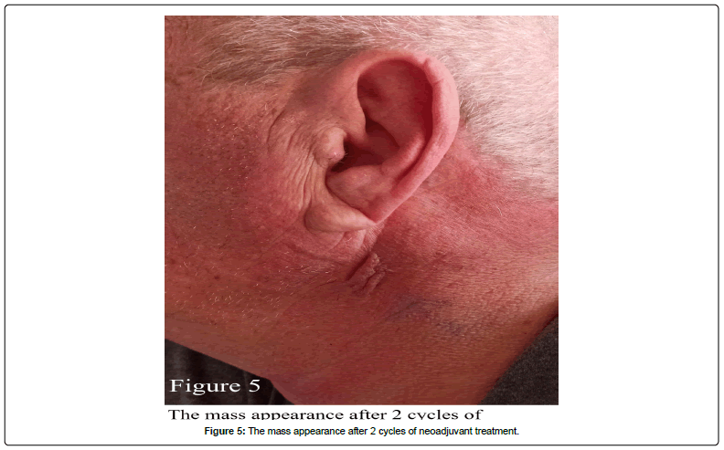 clinical-oncology-mass