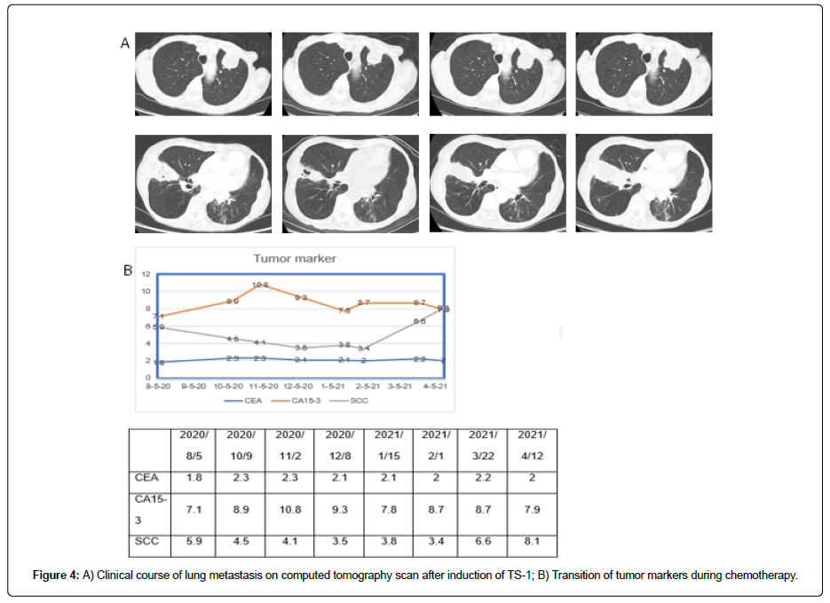 clinical-oncology-metastasis