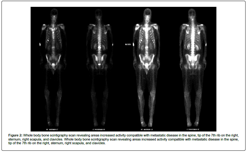 clinical-oncology-metastatic