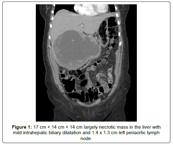 clinical-oncology-necrotic clinical-oncology-necrotic
