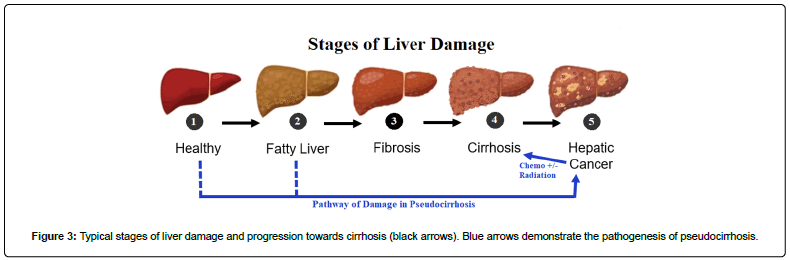 clinical-oncology-pathogenesis