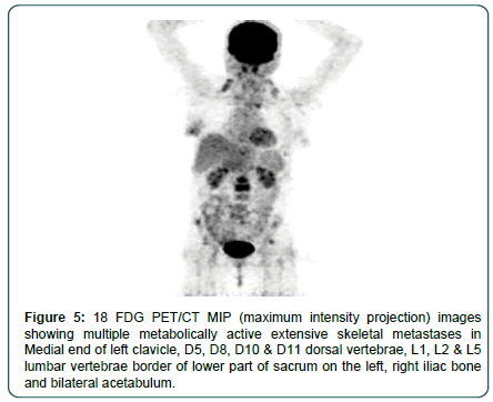 clinical-oncology-sacrum